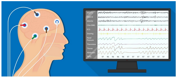 הפרעות קשב וריכוז (ADHD) -בעיות קשב וריכוז אבחון, סימנים וטיפול לילדים ומבוגרים